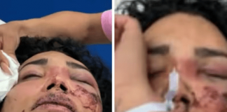 ¿Paola Suárez perderá un ojo por la paliza de su pareja? Esto dijo una de sus amigas